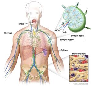 LymphomaPicture