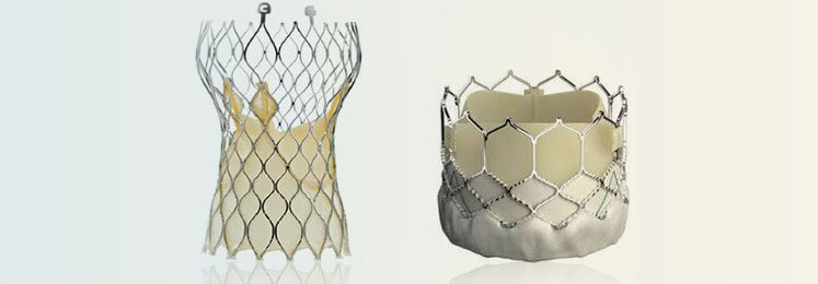 TAVR-Transcatheter-Aortic-Valve-ReplacementSansumClinic