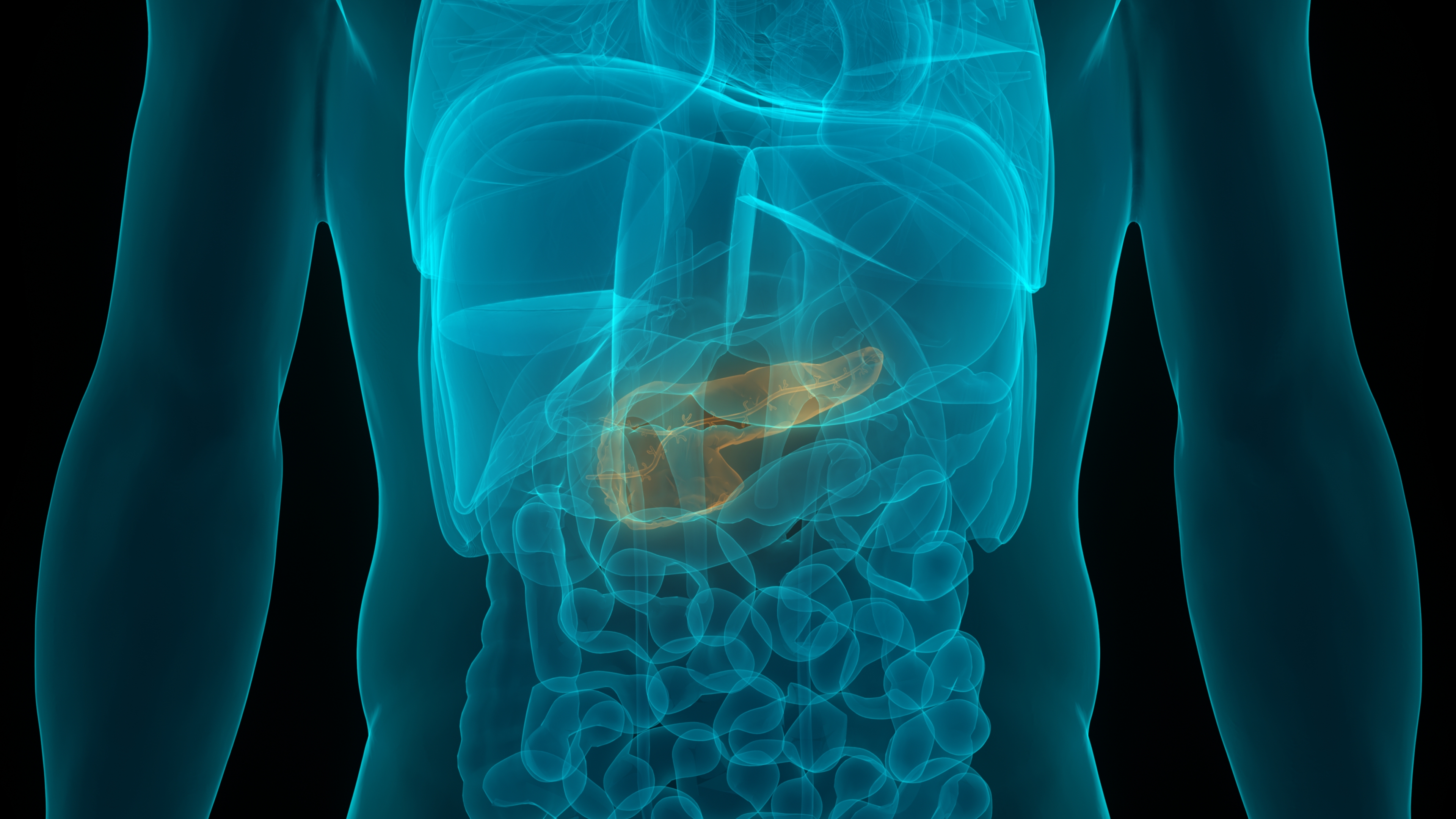 PancreaticCancer