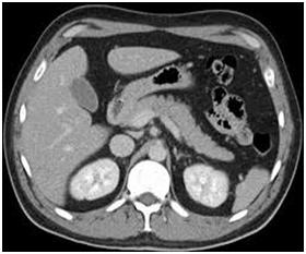 CTScanoftheAbdomen