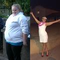 BariatricSurgeryWeightLoss