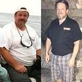 BariatricSurgeryWeightLossMan