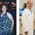 BariatricPatientDeannabeforeandafter