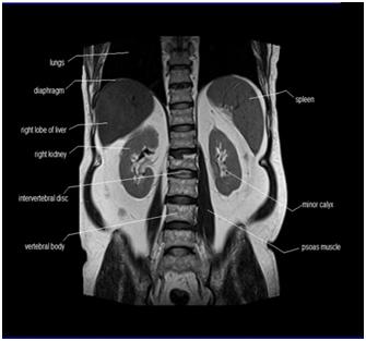 MRIoftheAbdomen