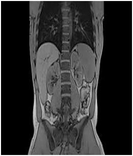 AbdominalMRI