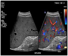 UltrasoundoftheAbdomen