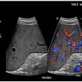 UltrasoundoftheAbdomen