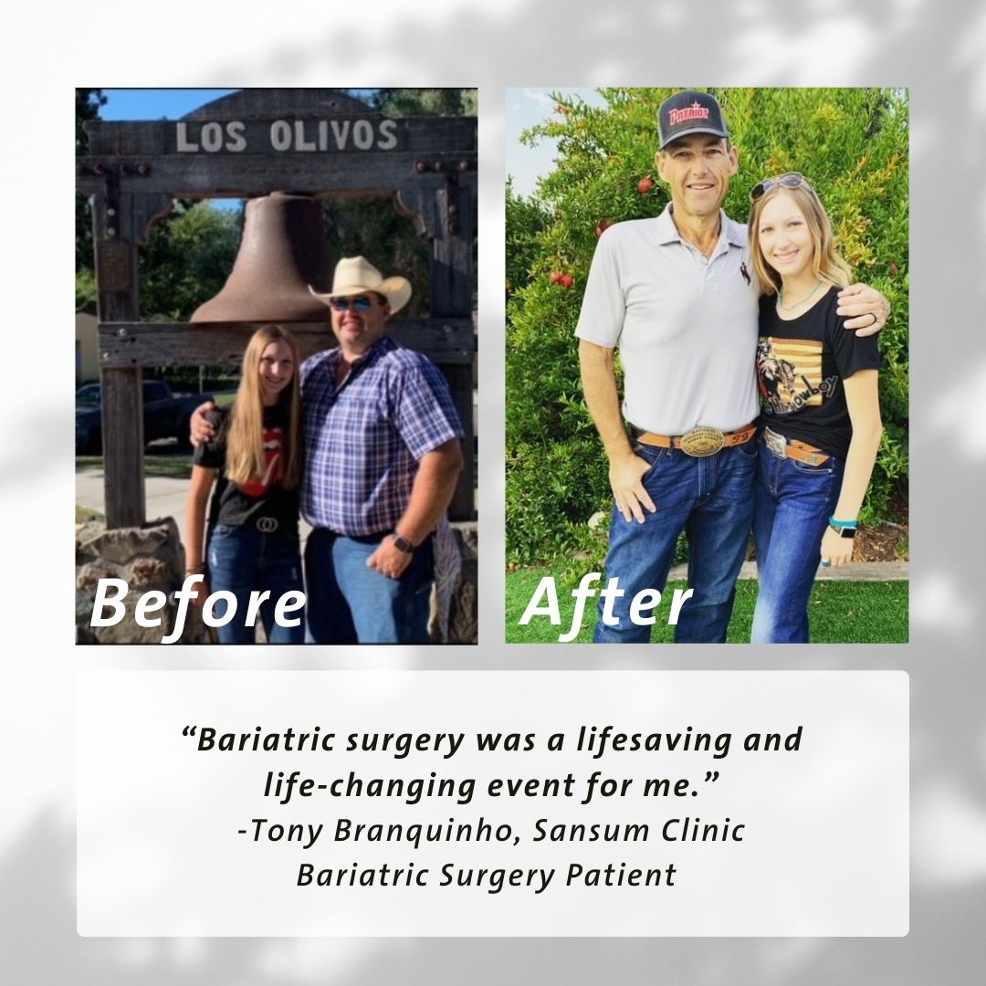 before and after bariatric surgery pictures